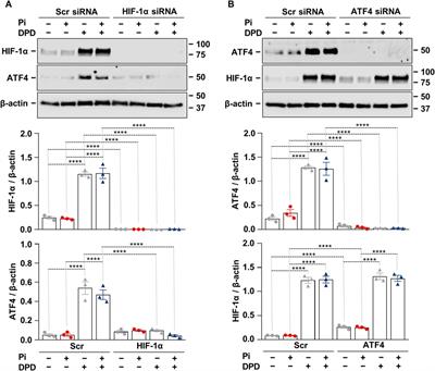 Activation of PERK/eIF2α/ATF4/CHOP branch of endoplasmic reticulum stress response and cooperation between HIF-1α and ATF4 promotes Daprodustat-induced vascular calcification